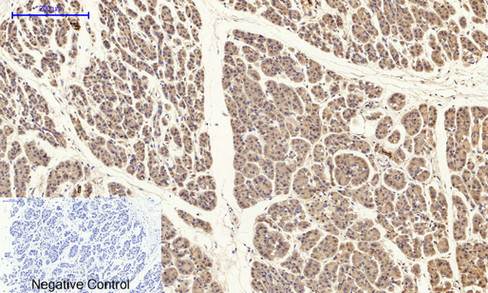 IHC - Bad Polyclonal Antibody AP68618